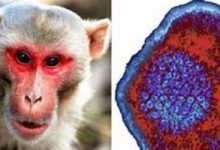 غينيا تسجل أول حالة إصابة مؤكدة بجدرى القرود